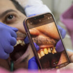 Cât durează refacerea danturii complete în România pentru diaspora